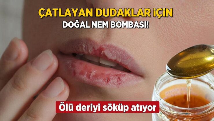 Kışın Çatlayan Dudaklara Doğal Nem Bombası! Ölü Deriyi Söküp Atıyor, 15 Dakika Kâfi