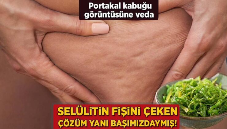 Selülitin Fişini 15 Dakikada Çeken Çözüm! Karıştırıp Streç Sinemayla Sarınca Yağ Gibi Eritiyor