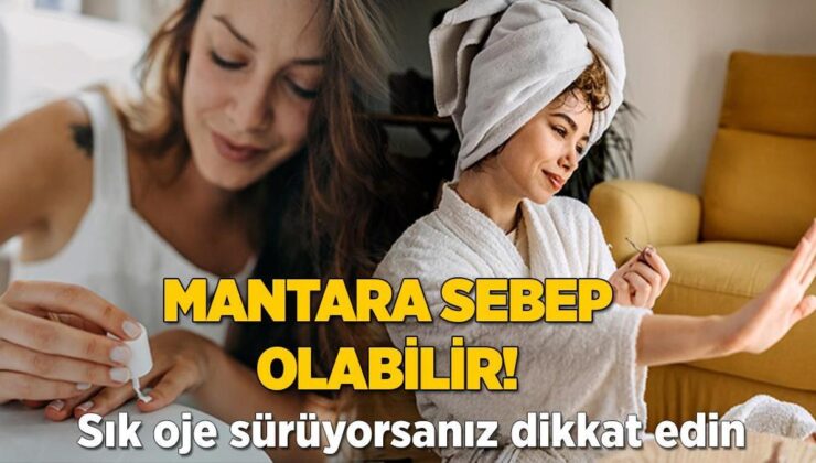 Tırnakları Sarı Sarı Mantar Kaplıyor! Oje Sürerken Unutmayın, Çizgi Oluşmasın