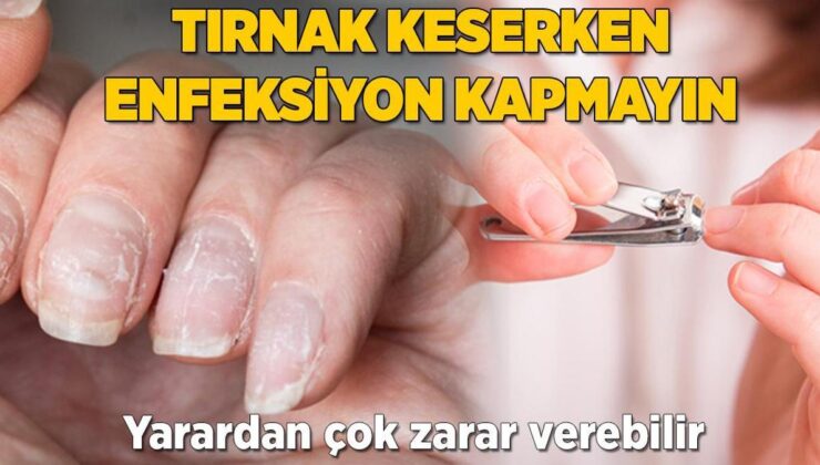 Herkes Bu Yanılgıyı Yapıyor, Mikrop Kapmayın! Tırnaklarınızı Böyle Kesin