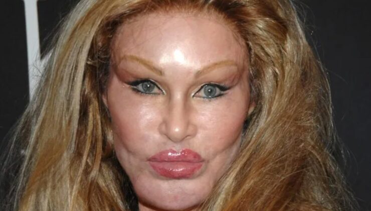 Kedi Kadın Jocelyn Wildenstein 84 Yaşında Hayatını Kaybetti