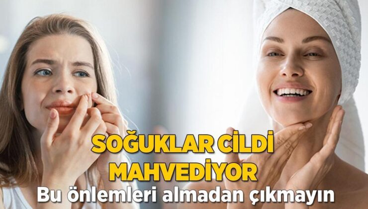 Soğuklar Cildi Mahvediyor! Bu Tedbirleri Almadan Çıkmayın