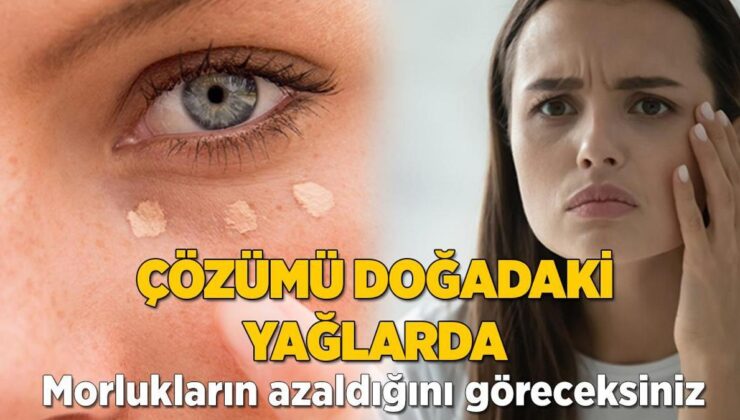 Tahlili Tabiattaki Yağlarda! Morlukları Azaltan Formül